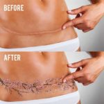 tattoos to cover up stretch marks